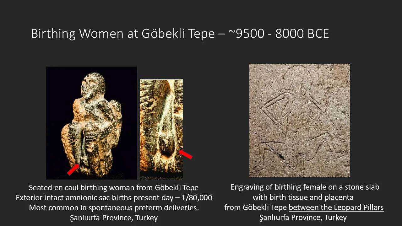 Göbekli Tepe Birthing Women