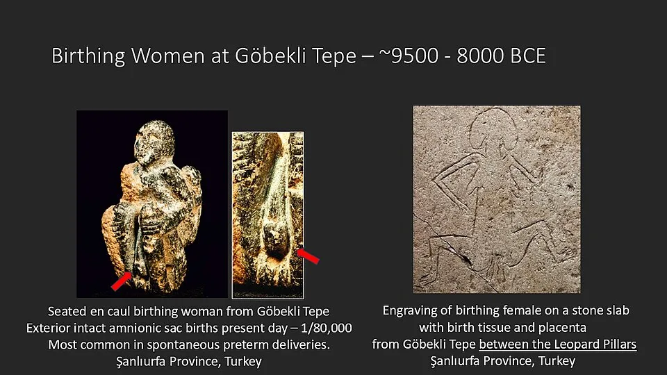 Göbekli Tepe Birthing Women